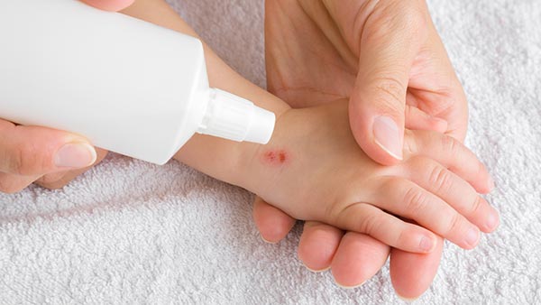 Childcare First Aid NSW Childcare First Aid NSW